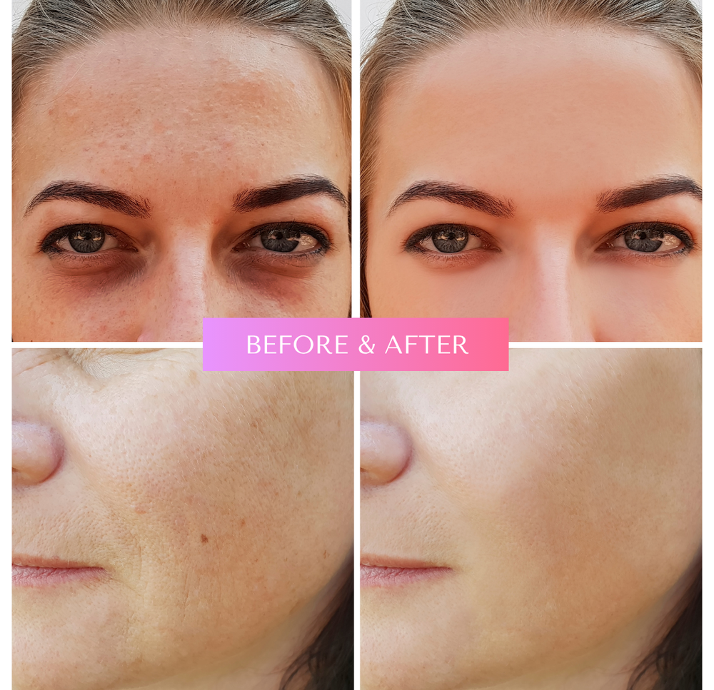 <h2>Loved by skin. Loved by all. Read why our customers are obsessed.</h2>