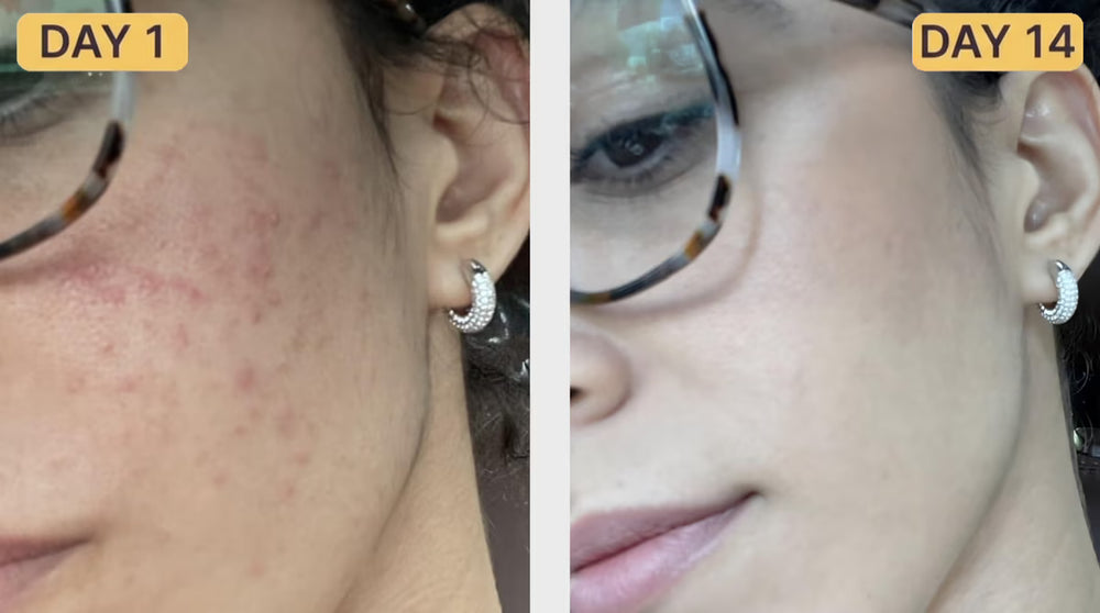 <h2>Loved by skin. Loved by all. Read why our customers are obsessed.</h2>